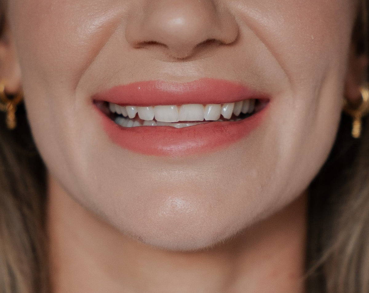 Keep the smile you earned.