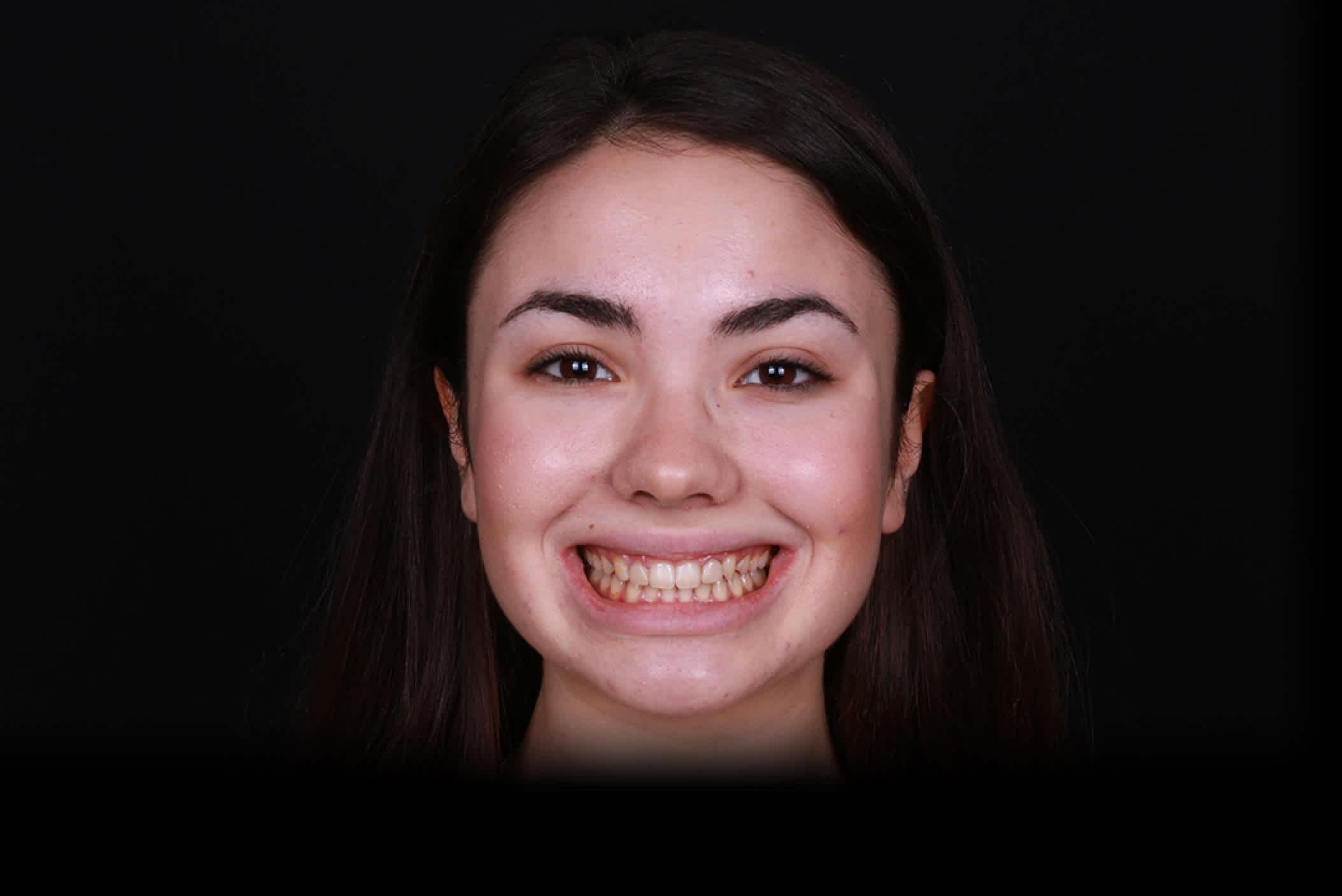 result-3-before - orthoclear
