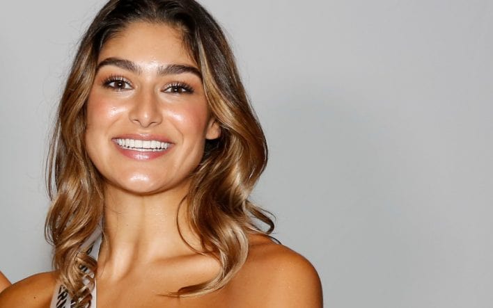 Orthoclear vs Invisalign vs DrSmile: Welke aligners zijn het best voor jou?