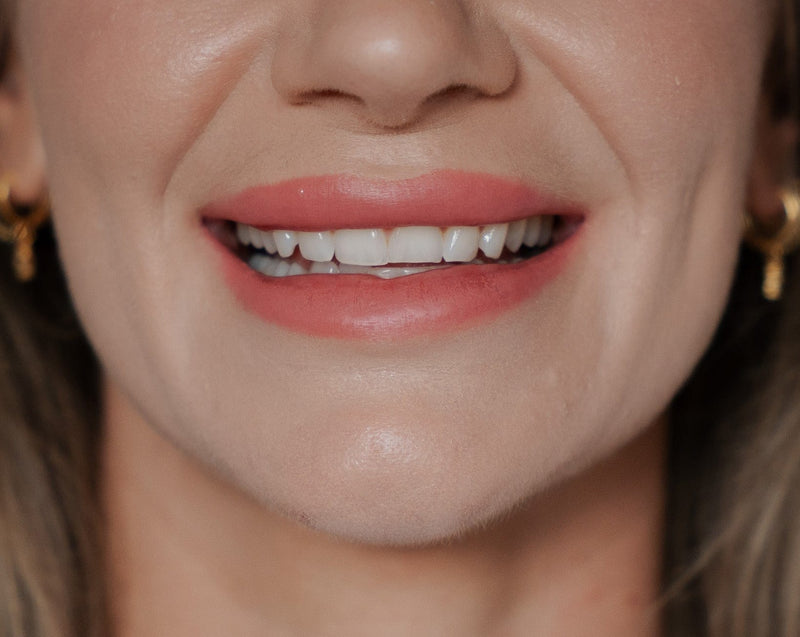Whiten at home